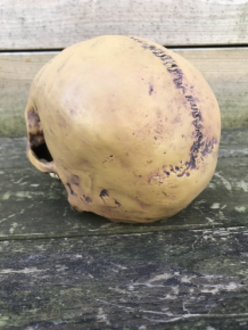 1 anatomische schedel, uit Polystein